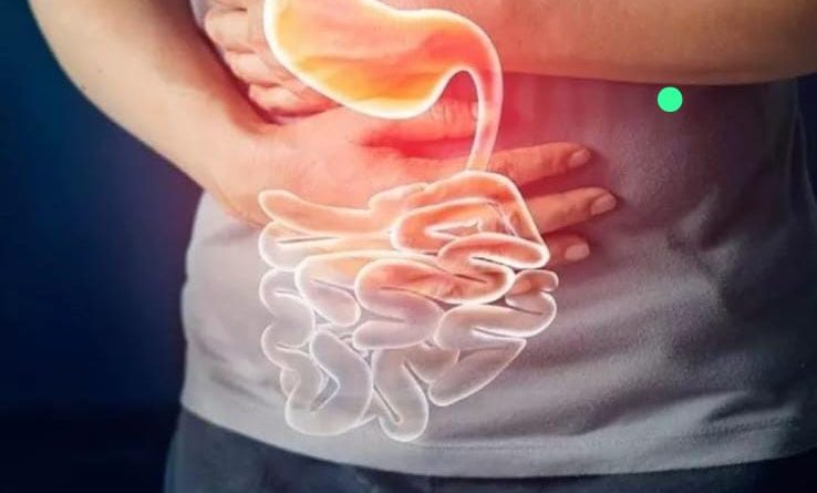 Colitis ulcerosa puede comenzar entre los 20 y 40 años de edad